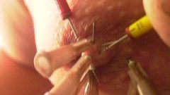 Needles In My Breasts 2